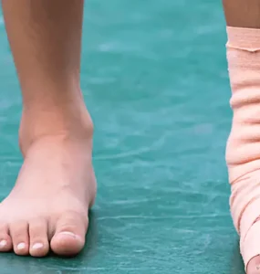 Compression Socks for Edema